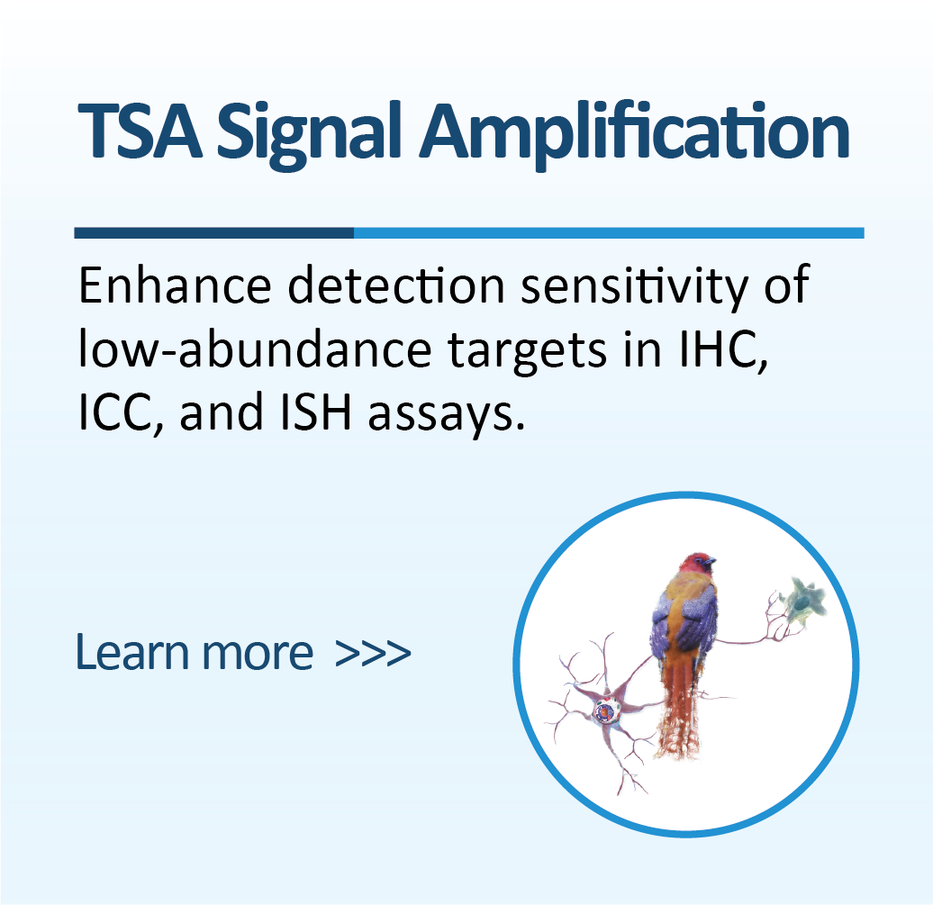 TSA Signal Amplification